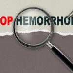 Stop Hemorroids